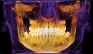 i-CAT teeth visualization
